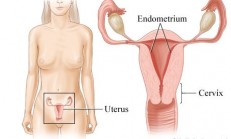 Doğum Sonrası Rahim Zarı İltihabı – Enfeksiyonu (Endometrit)