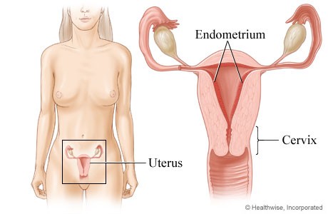 Doğum Sonrası Rahim Zarı İltihabı - Enfeksiyonu (Endometrit)