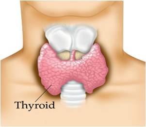 tiroyid