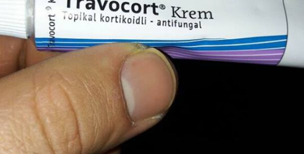 Travocort Kremi Pişik Tedavisine İyi Gelir mi Ne İşe Yarar Kullanıcı Yorumları